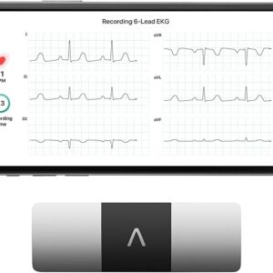 KardiaMobile 6-Lead Personal EKG Monitor